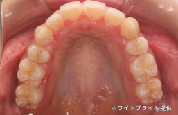 治療後
