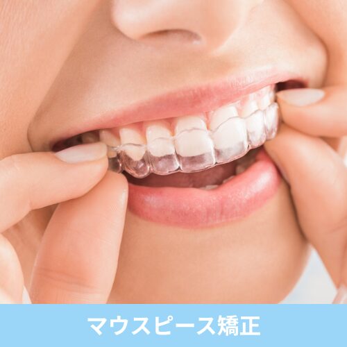 マウスピース矯正